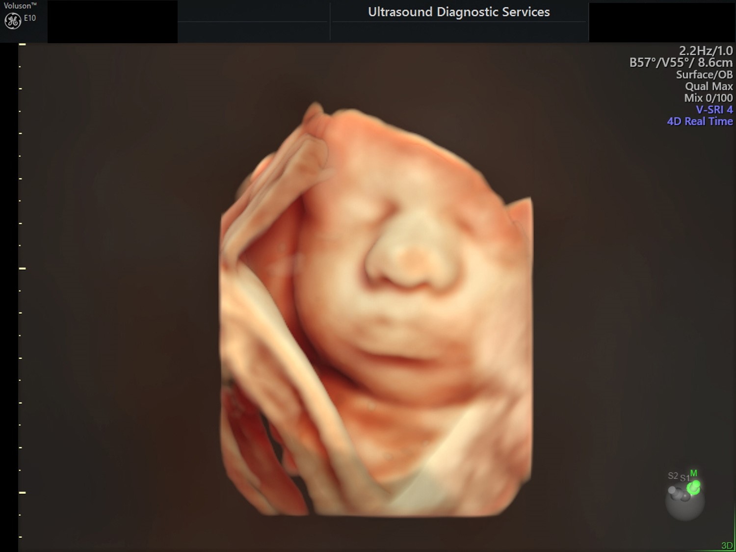 3D scan of fetus